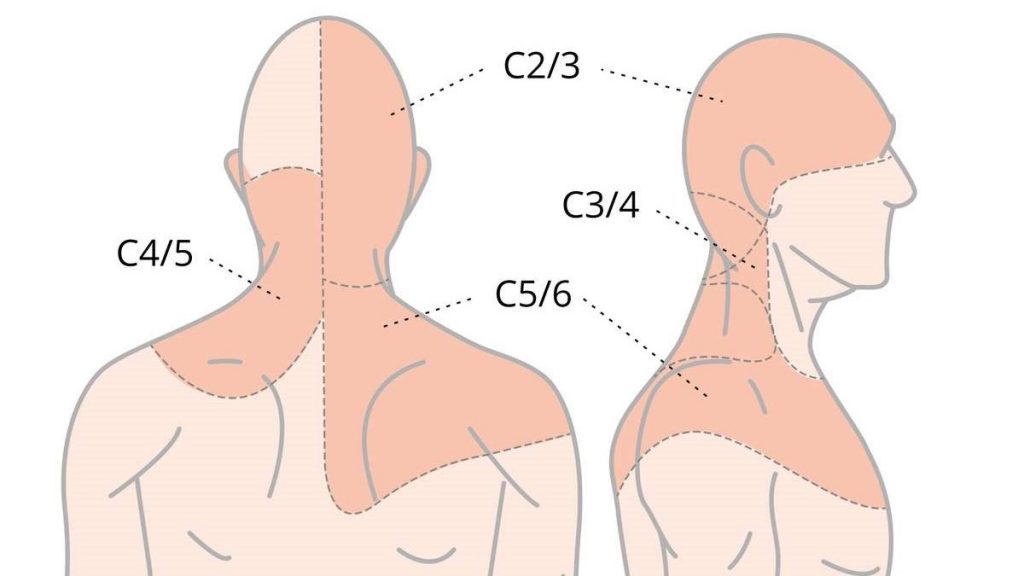 классификация боли в шее по типу лечения