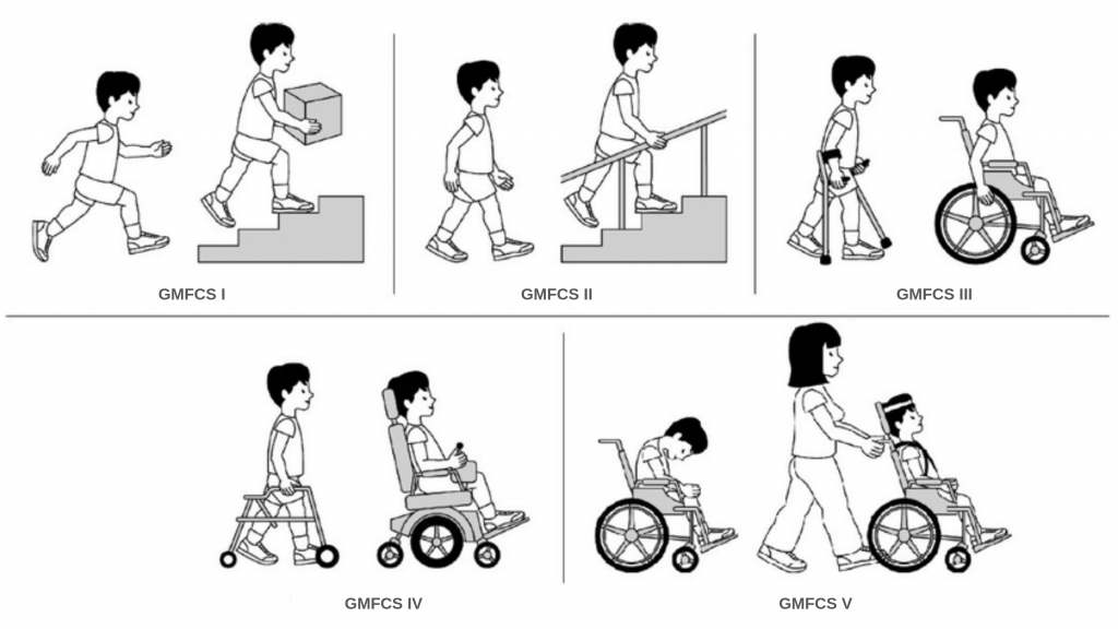детский церебральный паралич и мобильность