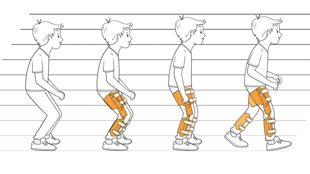 классификация паттернов ходьбы у детей с дцп