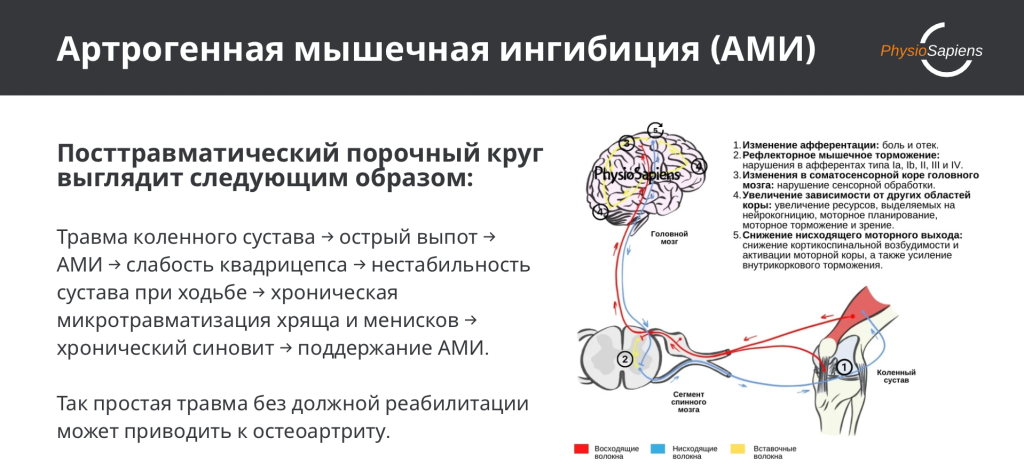 Как артрогенная мышечная ингибиция приводит к остеоартриту