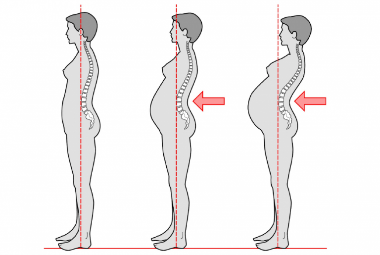 Боли сзади при беременности: когда паниковать, а когда — нет? Разбор причин