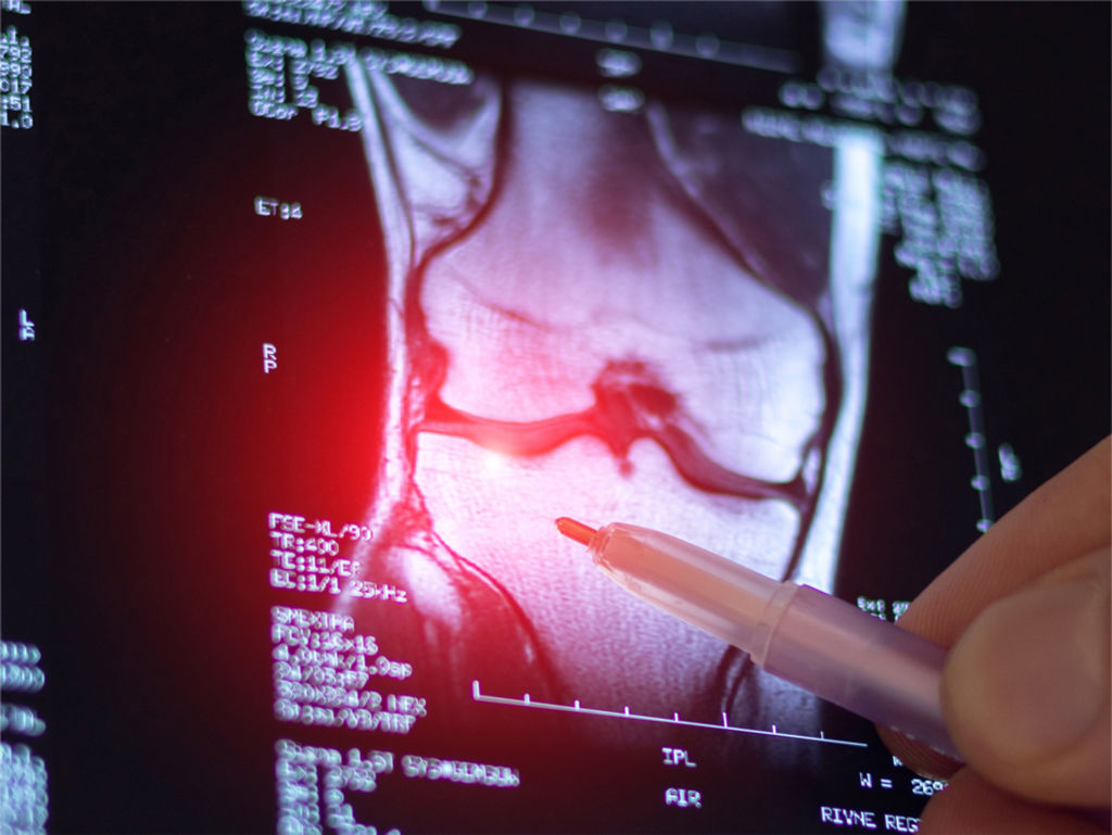 Курс для суставов и связок