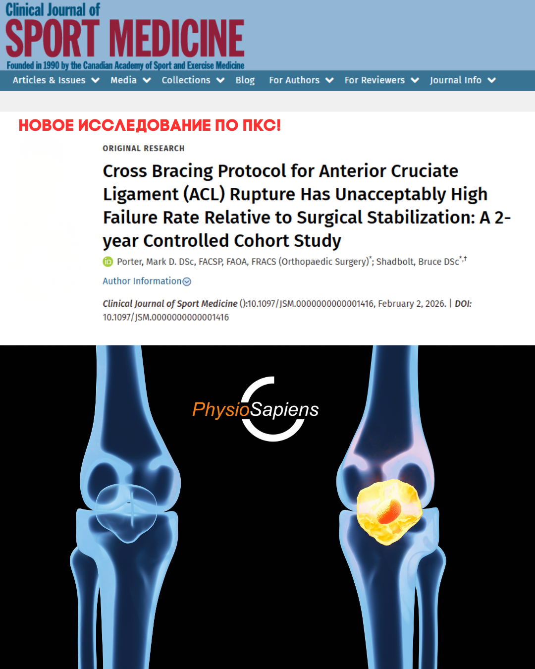 Протокол перекрестного брейсинга при разрыве передней крестообразной связки (ПКС) имеет неприемлемо высокий уровень неудач по сравнению с хирургической стабилизацией: контролируемое когортное исследование с двухлетним наблюдением