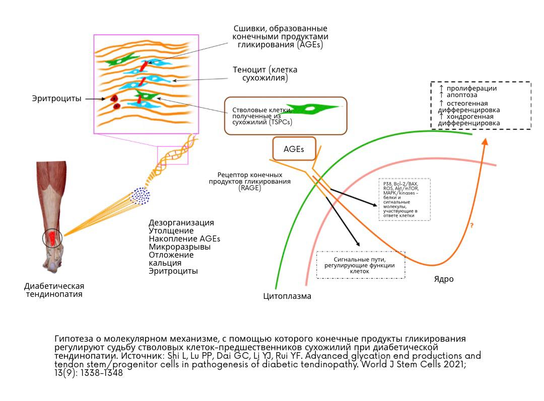 Влияние гипергликемии на опорно-двигательный аппарат и развитие болевого синдрома: научный обзор