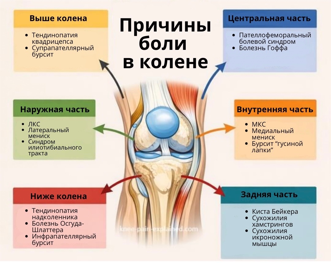 Боль в колене: причины, диагностика и лечение 