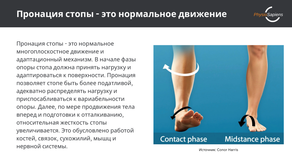 Пронация стопы - это нормальное движение